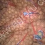 семенной картофель Импала.