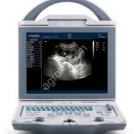 УЗИ-аппарат ветеринарный КХ5600 (KAIXIN) универсальный (новый)