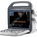 УЗИ-аппарат DCU10 (KAIXIN, КНР)