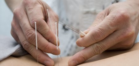 В Безенчукском районе коров лечат иглорефлексотерапией