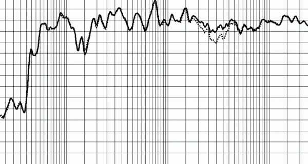 В 2011 году цены на молоко больше не вырастут