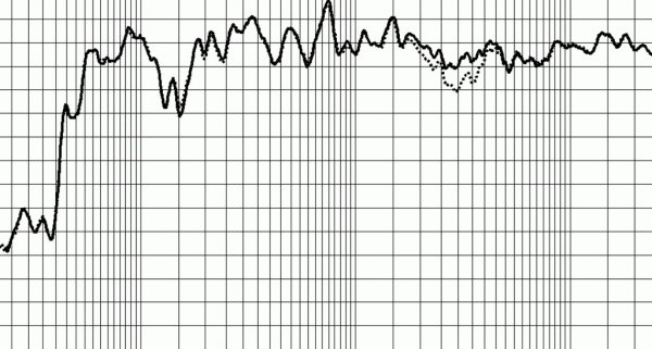 В 2011 году цены на молоко больше не вырастут