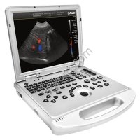 УЗИ с цветным допплером DAWEI L3