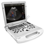 УЗИ с цветным допплером DAWEI L3